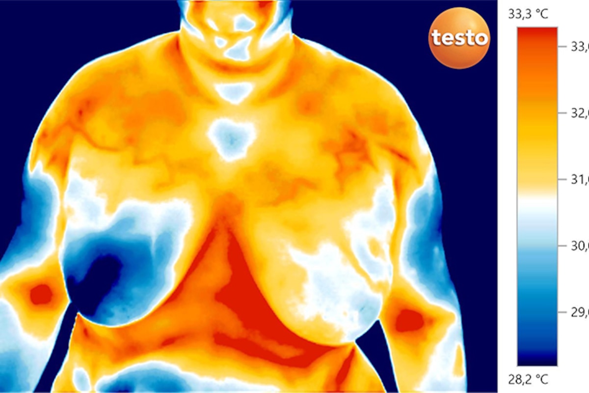 La thermographie pour dépister le cancer du sein